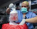 Especialista en prácticas de enfermería, saca el riñón de cerdo de su caja para prepararlo para el trasplante en el Hospital General de Massachusetts, el 16 de marzo de 2024, en Boston. AP/ARCHIVO