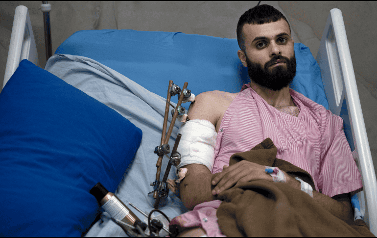 Mujahid Abadi recuperándose en el Hospital Especializado de Ibn Sina el martes 25 de junio del 2024. AP / M. ALLERUZZO
